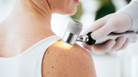 cropped view of dermatologist holding dermatoscope while examining patient