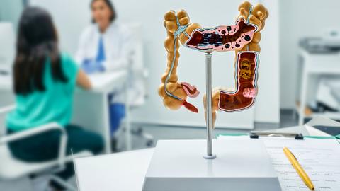 Gastroenterology consultation. Anatomical intestines model on doctor table over background gastroenterologist consulting female patient at medical clinic