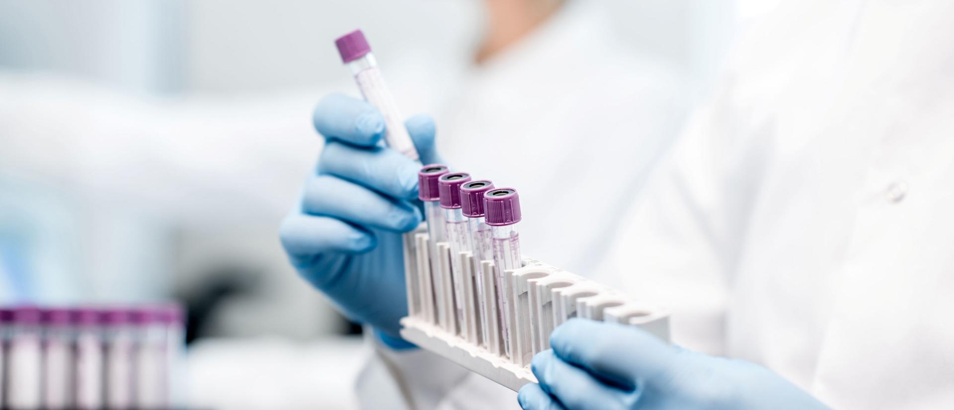 Laboratory assistant putting test tubes into the holder, close-up view focused on the tubes