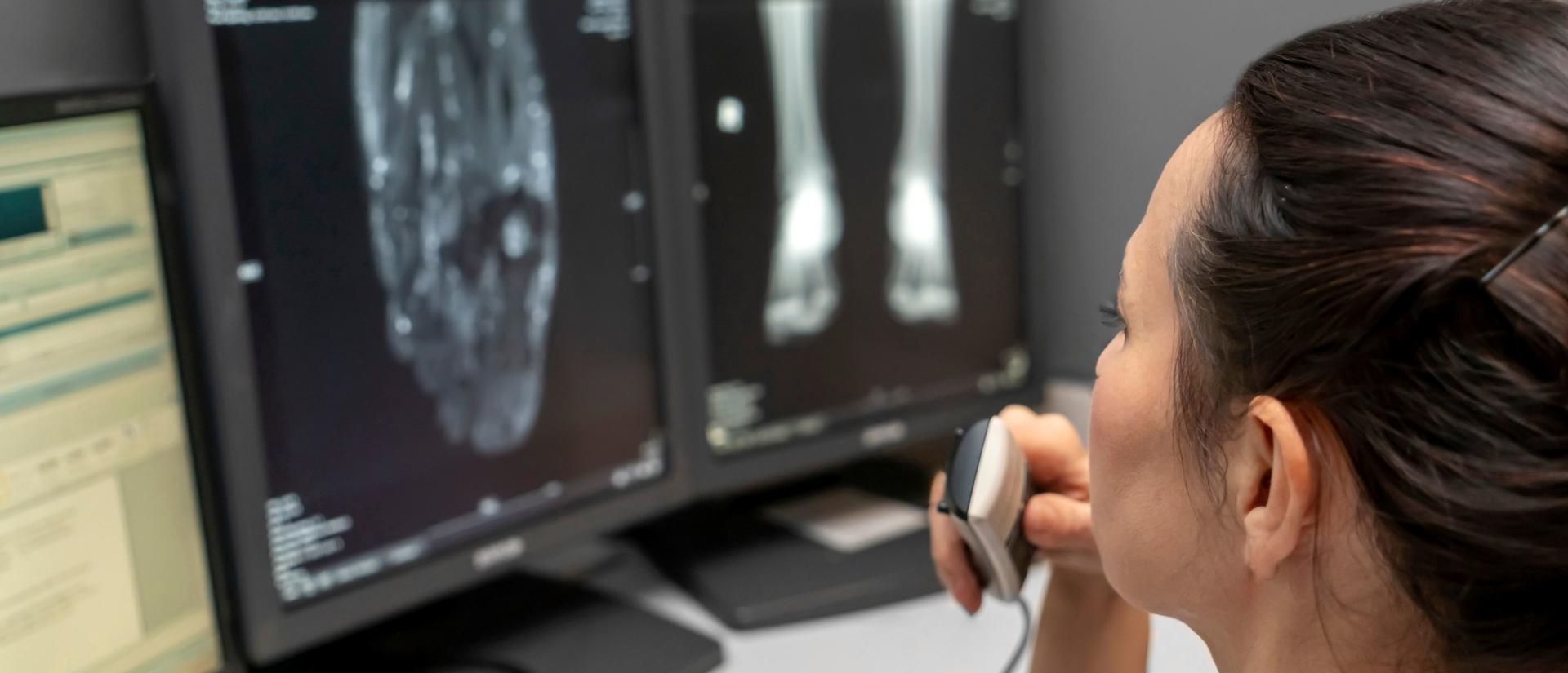 radiology doctor examines foot, ankle x-ray, mr image and reports with microphone looking computer screen